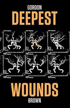 Deepest Wounds