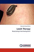 Image for Leech Therapy: Blood Letting in Non healing Ulcers Leech Therapy: Blood Letting in Non healing Ulcers