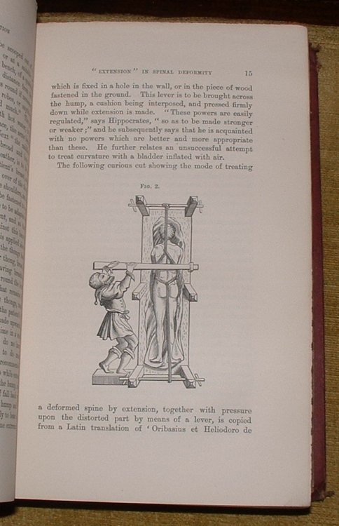 Orthopraxy for Mechanical Treatment of Deformities, Debilities, and Deficiencies of the Human Frame