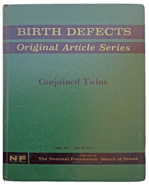 Image for Conjoined Twins. Conjoined Twins.