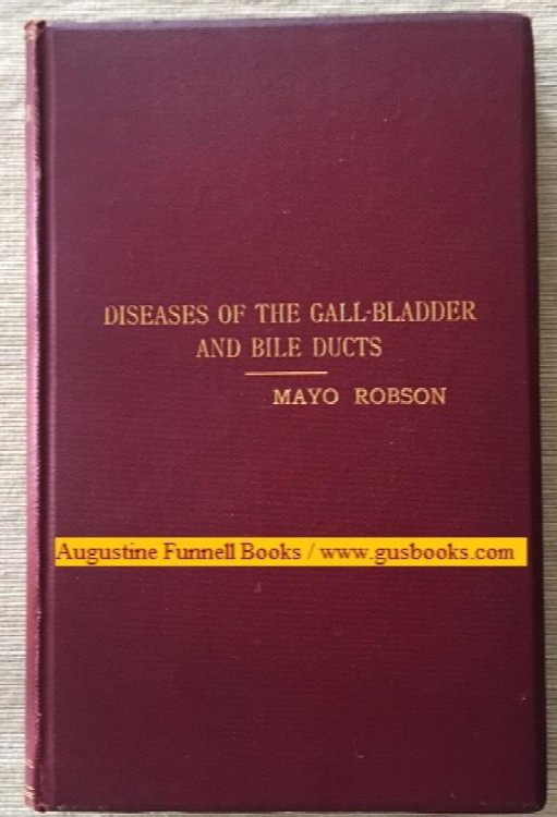 Image for Diseases of the Gall-Bladder and Bile-Ducts Diseases of the Gall-Bladder and Bile-Ducts