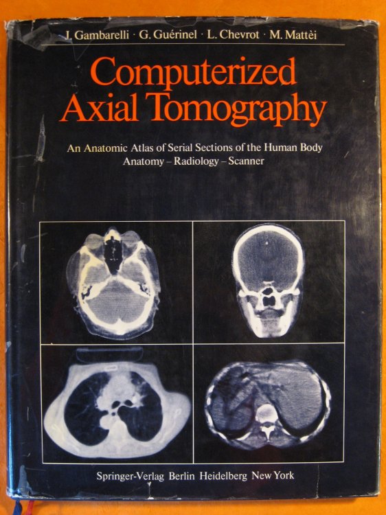 Image for Computerized Axial Tomography: An Anatomic Atlas of Serial Sections of the Human Body. Anatomy, Radiology, Scanner Computerized Axial Tomography: An Anatomic Atlas of Serial Sections of the Human Body. Anatomy, Radiology, Scanner