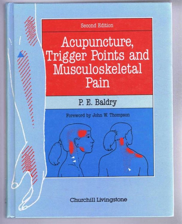 Image for Acupuncture, Trigger Points and Musculoskeletal Pain Acupuncture, Trigger Points and Musculoskeletal Pain