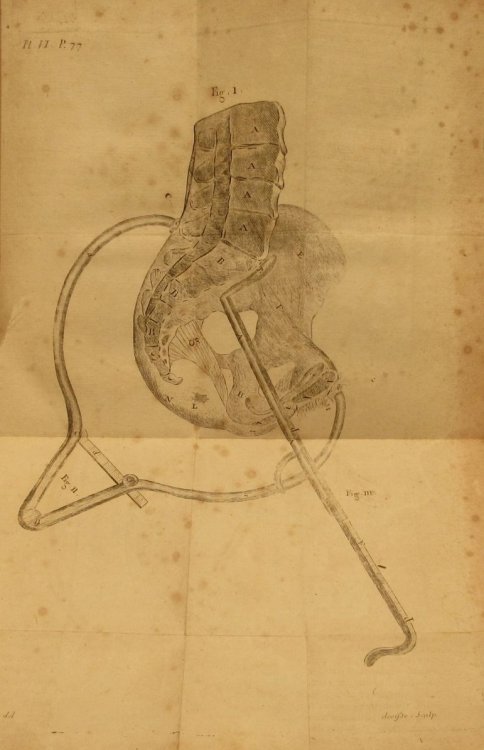 Image for L'Art des Accouchemens. Revue, corrigee, et augmentee. Volumes I & II. L'Art des Accouchemens. Revue, corrigee, et augmentee. Volumes I & II.