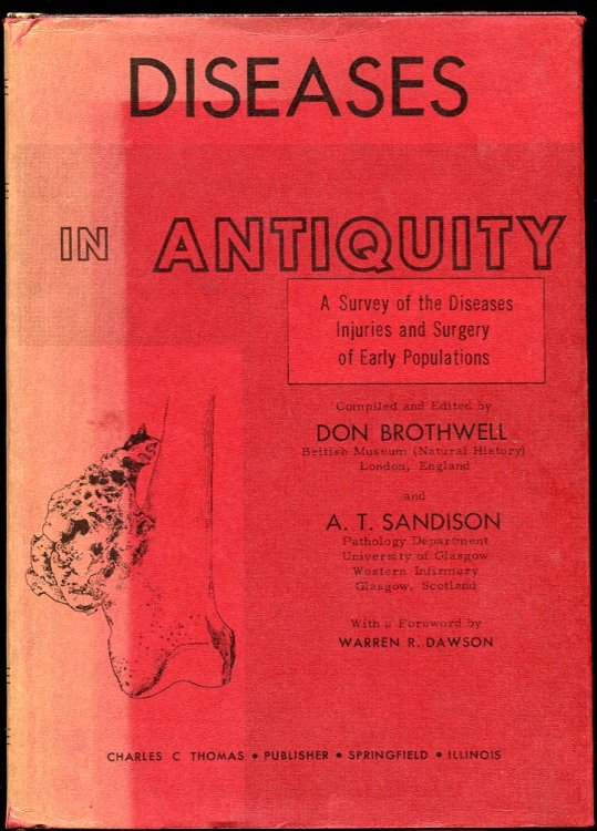 Image for Diseases in Antiquity. a Survey of the Diseases, Injuries and Surgery of Early Populations Diseases in Antiquity. a Survey of the Diseases, Injuries and Surgery of Early Populations