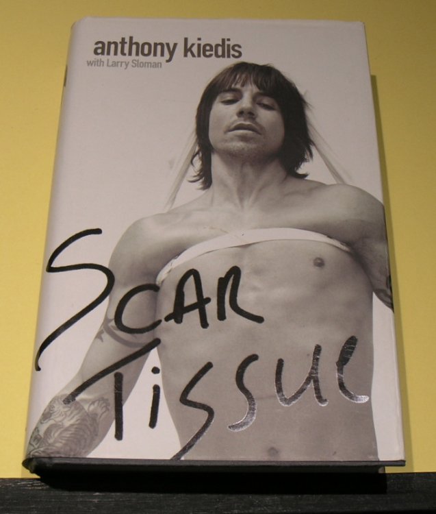Anthony Kiedis