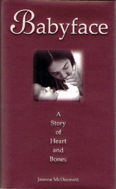 Babyface: A Story of Heart and Bones