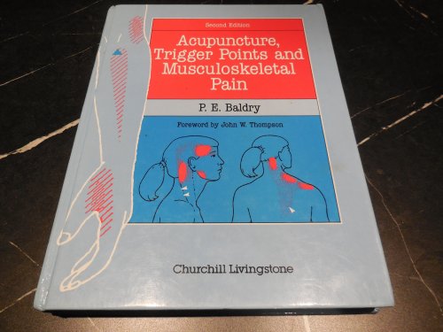 Acupuncture, Trigger Points and Musculoskeletal Pain: A Scientific Approach to Acupuncture