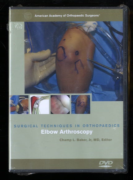 Image for Elbow Arthroscopy Elbow Arthroscopy