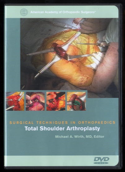 Image for Total Shoulder Arthroplasty Total Shoulder Arthroplasty